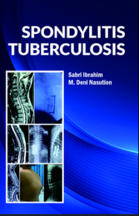 Spondylitis Tuberculosis