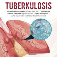 Tuberkulosis